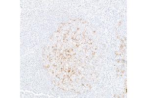Immunohistochemistry (IHC) image for anti-Programmed Cell Death 1 Ligand 2 (PDCD1LG2) (AA 20-220) antibody (ABIN7795675)