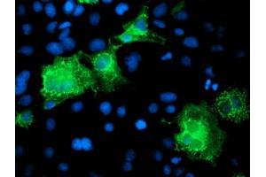 Anti-KATNB1 mouse monoclonal antibody (ABIN2455210) immunofluorescent staining of COS7 cells transiently transfected by pCMV6-ENTRY KATNB1 (RC201852). (KATNB1 抗体)