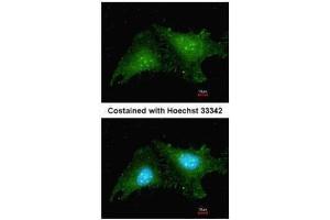 ICC/IF Image Immunofluorescence analysis of methanol-fixed HeLa, using RNF25, antibody at 1:200 dilution. (RNF25 抗体  (C-Term))