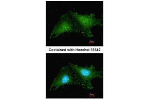 ICC/IF Image Immunofluorescence analysis of methanol-fixed HeLa, using RNF25, antibody at 1:200 dilution. (RNF25 抗体  (C-Term))