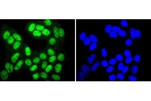 HeLa cells were stained with SIRT1(T530) (6H5) Monoclonal Antibody  at [1:200] incubated overnight at 4C, followed by secondary antibody incubation, DAPI staining of the nuclei and detection. (SIRT1 抗体  (pThr530))