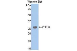 Western Blotting (WB) image for anti-Trypsin (AA 9-231) antibody (ABIN1077670) (Trypsin 抗体  (AA 9-231))