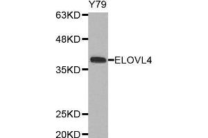 Western blot analysis of extracts of Y79 cell line, using ELOVL4 antibody. (ELOVL4 抗体  (AA 1-100))