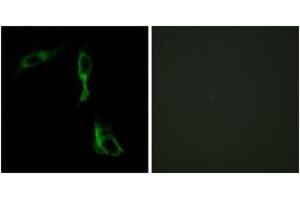 Immunofluorescence analysis of HeLa cells, using ADRA1D Antibody. (ADRA1D 抗体  (AA 451-500))