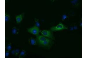 Anti-KLHL2 mouse monoclonal antibody (ABIN2453211) immunofluorescent staining of COS7 cells transiently transfected by pCMV6-ENTRY KLHL2 (RC205347). (KLHL2 抗体  (AA 1-100, AA 494-593))