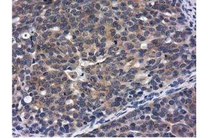 Immunohistochemistry (IHC) image for anti-COBW Domain Containing 1 (CBWD1) antibody (ABIN1497117) (CBWD1 抗体)