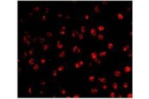 Immunofluorescence of AID in Ramos cells with AP30028PU-N Ramos antibody at 20 μg/ml. (AICDA 抗体  (C-Term))