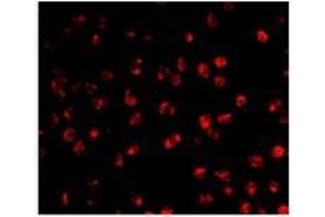 Immunofluorescence of AID in Ramos cells with AP30028PU-N Ramos antibody at 20 μg/ml.