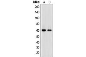 Western blot analysis of DNA Polymerase epsilon 2 expression in HL60 (A), HeLa (B) whole cell lysates. (POLE2 抗体  (Center))