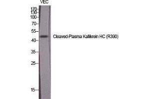 Western Blot (WB) analysis of specific cells using Cleaved-Plasma Kallikrein HC (R390) Polyclonal Antibody. (Plasma Kallikrein HC (Arg390), (cleaved) 抗体)