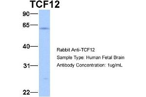 Host:  Rabbit  Target Name:  TCF12  Sample Type:  Human Fetal Brain  Antibody Dilution:  1. (TCF12 抗体  (N-Term))