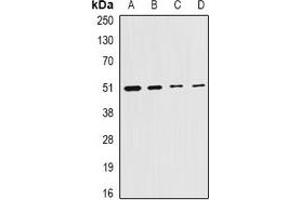 Western blot analysis of Citrate Synthase expression in HepG2 (A), MCF7 (B), mouse liver (C), rat testis (D) whole cell lysates. (CS 抗体)