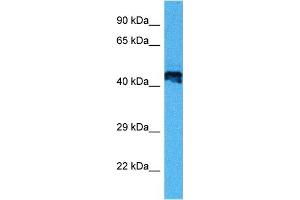 Host:  Mouse  Target Name:  E2F2  Sample Tissue:  Mouse Heart  Antibody Dilution:  1ug/ml (E2F2 抗体  (Middle Region))