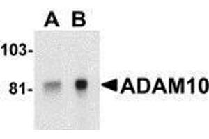 Western Blotting (WB) image for anti-ADAM Metallopeptidase Domain 10 (ADAM10) antibody (ABIN2478644)