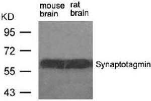 Image no. 2 for anti-Synaptotagmin I (SYT1) (Ser309) antibody (ABIN401634) (SYT1 抗体  (Ser309))