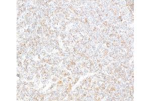 anti-REL proto-oncogene (c-Rel) (C-Term) antibody