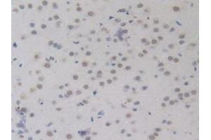 Immunohistochemistry (IHC) image for anti-Bone Morphogenetic Protein 15 (BMP15) (AA 274-390) antibody (ABIN7441940)