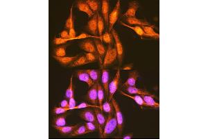 Immunofluorescence analysis of U-2 OS cells using hnRNP E1/hnRNP E1/PCBP1 Rabbit pAb (ABIN6134408, ABIN6145277, ABIN6145278 and ABIN6214692) at dilution of 1:100 (40x lens). (PCBP1 抗体  (AA 100-200))