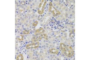 Immunohistochemistry of paraffin-embedded mouse kidney using TSC22D3 Antibody. (TSC22D3 抗体  (AA 1-79))