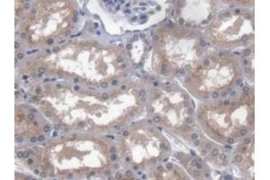 DAB staining on IHC-P; Samples: Human Kidney Tissue (PTTG1IP 抗体  (AA 33-96))
