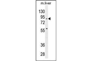 Western blot analysis in mouse liver tissue lysates (35 µg/lane) using SPIRE2 antibody (Center) Cat.