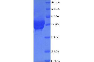 SDS-PAGE (SDS) image for Complement Component C4b (C4b) (AA 1454-1744) protein (His tag) (ABIN5713996)