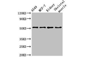 Western Blot Positive WB detected in: A549 whole cell lysate, MCF-7 whole cell lysate, Mouse kidney tissue, Mouse skeletal muscle tissue All lanes: NARF antibody at 3 μg/mL Secondary Goat polyclonal to rabbit IgG at 1/50000 dilution Predicted band size: 52, 57, 46, 45 kDa Observed band size: 52 kDa (NARF 抗体  (AA 10-41))