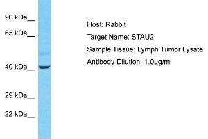 Host: Rabbit Target Name: STAU2 Sample Tissue: Human Lymph Tumor Antibody Dilution: 1ug/ml (Double-stranded RNA-binding protein Staufen homolog 2 (STAU2) (C-Term) 抗体)