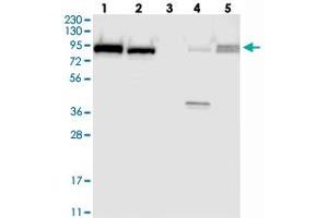 Western blot analysis of Lane 1: RT-4, Lane 2: U-251 MG, Lane 3: Human Plasma, Lane 4: Liver, Lane 5: Tonsil with FAM129B polyclonal antibody  at 1:250-1:500 dilution.