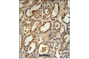 DCP2 Antibody (Center) (ABIN653129 and ABIN2842708) IHC analysis in formalin fixed and paraffin embedded human kidney tissue followed by peroxidase conjugation of the secondary antibody and DAB staining. (DCP2 抗体  (AA 144-173))
