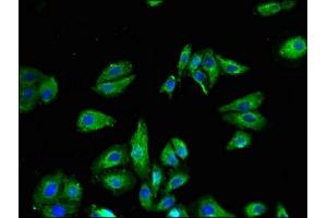 Immunofluorescence (IF) image for anti-Transient Receptor Potential Cation Channel, Subfamily V, Member 1 (TRPV1) (AA 1-155) antibody (ABIN7172875)