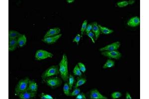 Immunofluorescent analysis of HepG2 cells using ABIN7172875 at dilution of 1:100 and Alexa Fluor 488-congugated AffiniPure Goat Anti-Rabbit IgG(H+L) (TRPV1 抗体  (AA 1-155))