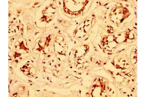 Immunohistochemistry (IHC) image for anti-Epithelial Splicing Regulatory Protein 2 (ESRP2) (AA 615-720) antibody (ABIN7151937)