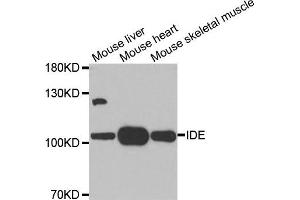 Western blot analysis of extracts of various tissues, using IDE antibody. (IDE 抗体)