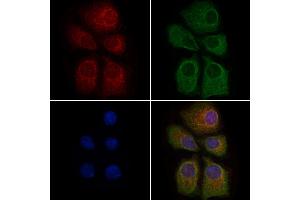 ABIN6263370 and ABIN6279022 staining HepG2 cells by IF/ICC.