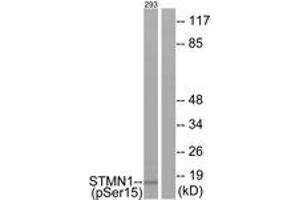 Western blot analysis of extracts from 293 cells, using Stathmin 1 (Phospho-Ser15) Antibody. (Stathmin 1 抗体  (pSer16))