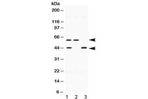 Western blot testing of human 1) HeLa, 2) U-2 OS and 3) MCF7 lysate with E2F4 antibody at 0. (E2F4 抗体  (AA 106-144))