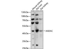 Western blot analysis of extracts of various cell lines, using AADAC antibody (ABIN6129182, ABIN6136311, ABIN6136313 and ABIN6218113) at 1:1000 dilution. (AADAC 抗体  (AA 170-399))
