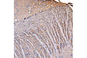 IHC analysis of GNAL using anti-GNAL antibody (ABIN7599757).