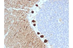 Formalin-fixed, paraffin-embedded human Cerebellum stained with CA8 Mouse Monoclonal Antibody (CPTC-CA8-2).