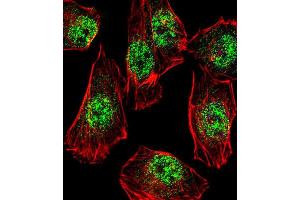 Immunofluorescence (IF) image for anti-Rhox Homeobox Family, Member 2B (RHOXF2B) antibody (ABIN3000753) (RHOXF2B 抗体)