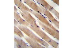 Formalin fixed, paraffin embedded human skeletal muscle stained with RHEB Antibody (C-term) followed by peroxidase conjugation of the secondary antibody and DAB staining.