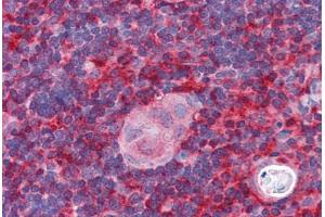 Human Thymus (formalin-fixed, paraffin-embedded) stained with ARPC1B antibody ABIN351466 at 2. (ARPC1B 抗体  (AA 2-14))