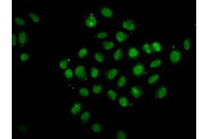 Immunofluorescence (IF) image for anti-Protein tyrosine Phosphatase, Non-Receptor Type 14 (PTPN14) (AA 220-351) antibody (ABIN7174097)