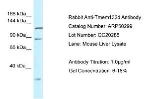 WB Suggested Anti-Tmem132d Antibody   Titration: 1. (TMEM132D 抗体  (Middle Region))