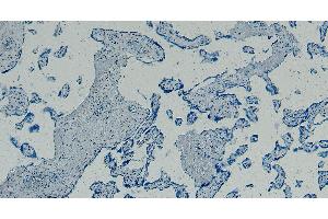 ABIN334408 Negative Control showing staining of paraffin embedded Human Placenta, with no primary antibody. (GBX2 抗体  (Internal Region))