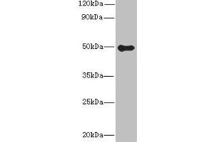 Western blot All lanes: GSDMB antibody at 8 μg/mL + Colo320 whole cell lysate Secondary Goat polyclonal to rabbit IgG at 1/10000 dilution Predicted band size: 47, 46, 48, 19 kDa Observed band size: 47 kDa (Gasdermin B 抗体  (AA 63-310))