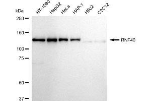 Western blotting analysis using RNF40 antibody (ABIN7800634). (Recombinant TRIM40 抗体)