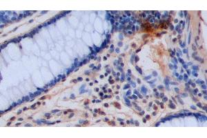 Immunohistochemistry (IHC) image for anti-5-Hydroxytryptamine (5-HT) antibody (ABIN7429649)
