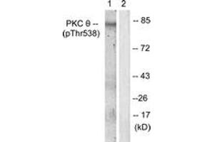 Western blot analysis of extracts from Jurkat cells, using PKC thet (Phospho-Thr538) Antibody. (PKC theta 抗体  (pThr538))